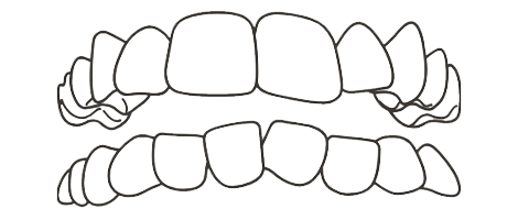 crooket teeth
