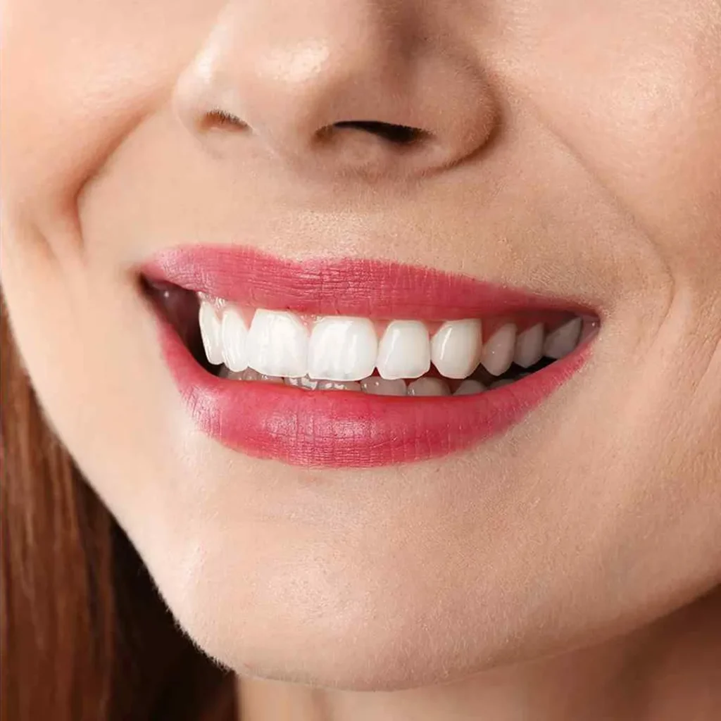 Smile